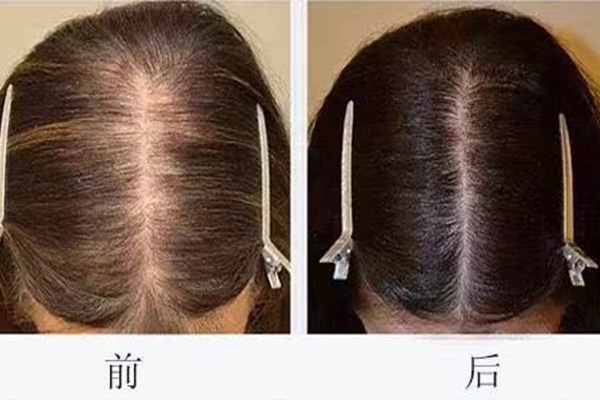 福州织发 福州织发
