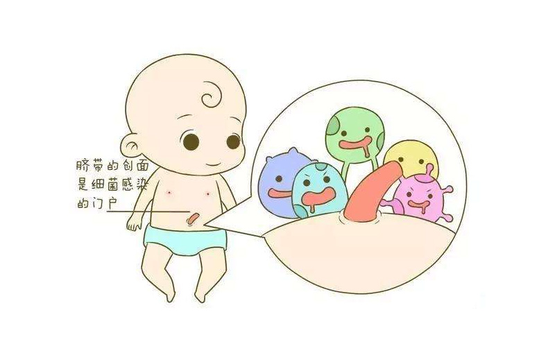 新生儿脐炎的护理 新生儿脐炎的护理