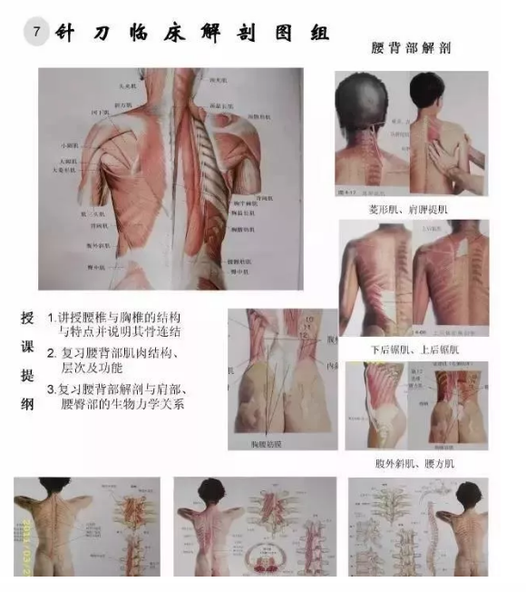 【针刀培训班】针刀临床解剖图干货知识赶快收了