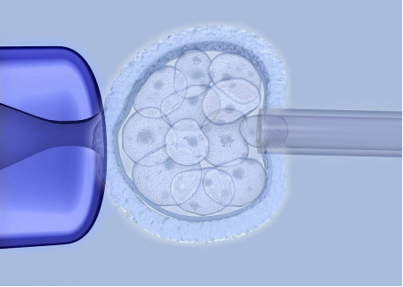 试管婴儿​取卵空泡和促排方案有关系吗？