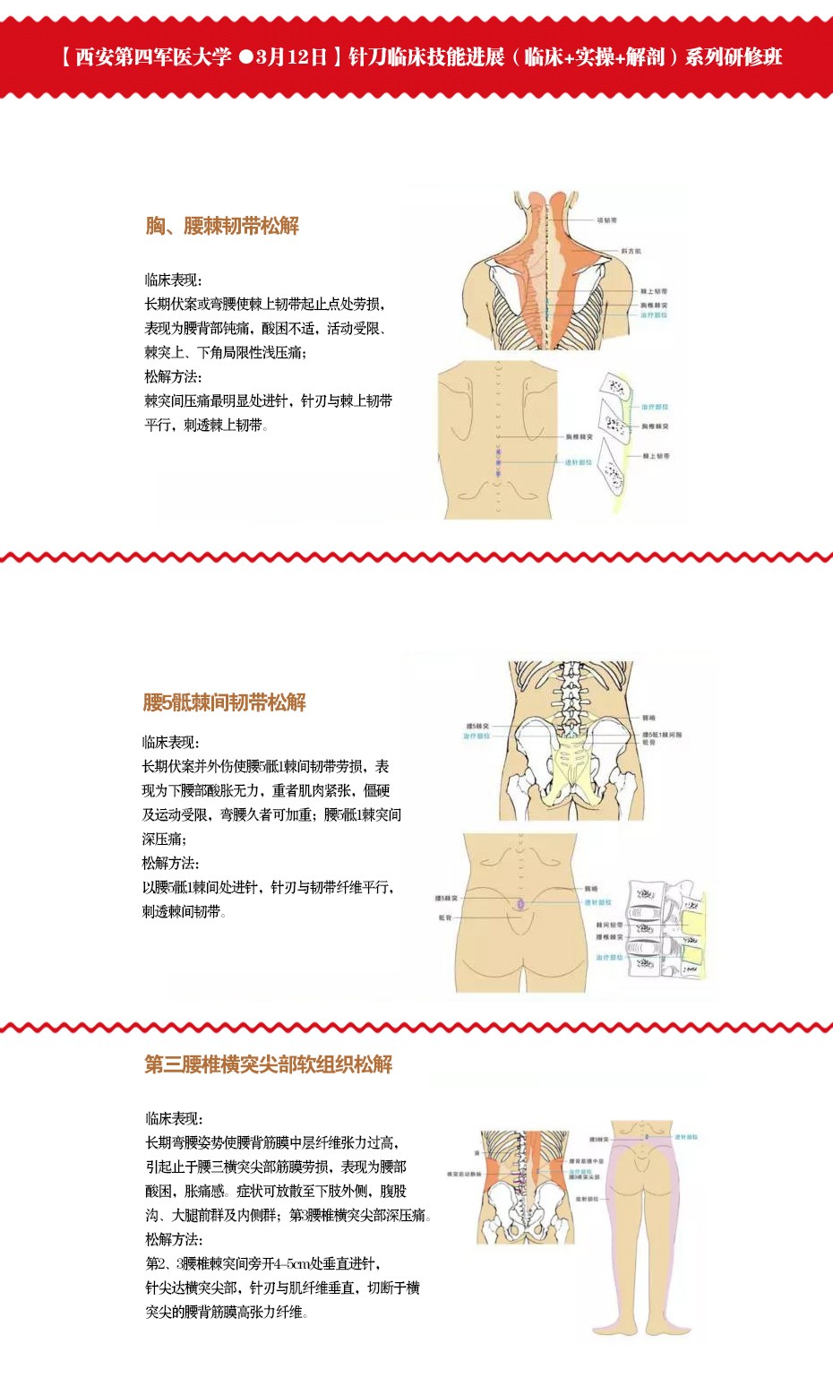 3月19日针刀临床技能，包含了（临床经验+实操技术+解剖要点）系列研修班于浙江•杭州开课啦！！！