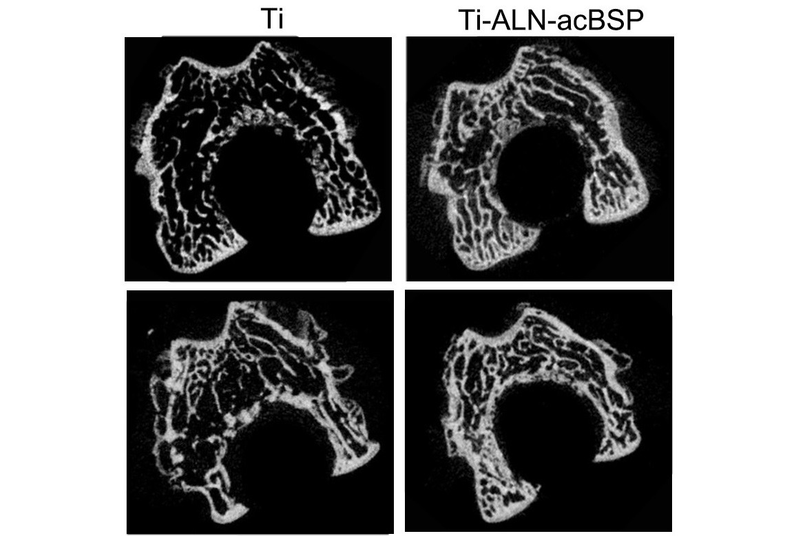 澳大新生物材料促进骨种植体疗效