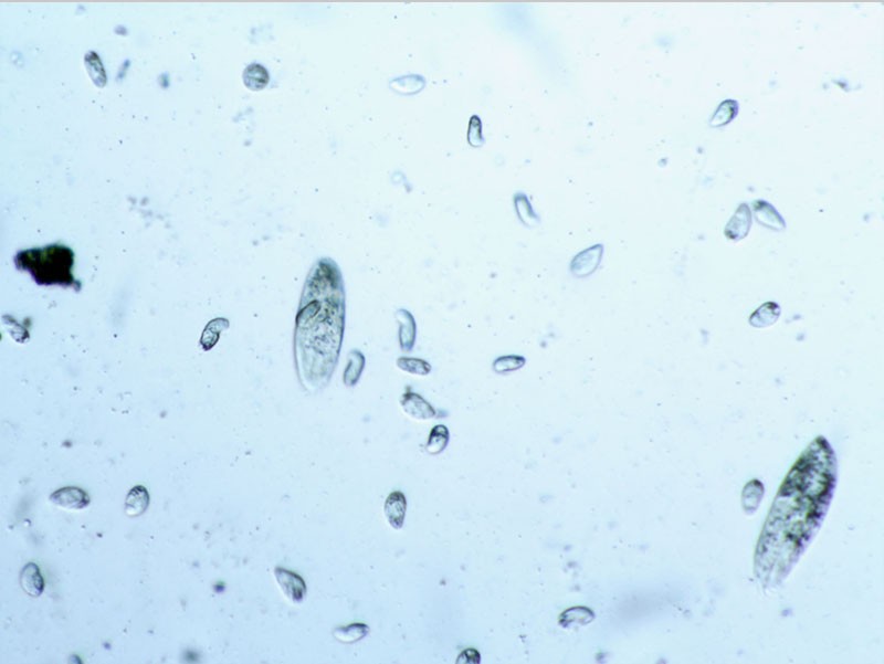 HWO生物膜法優勢