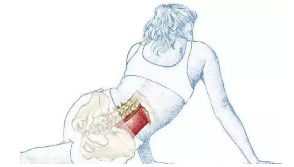【针刀培训班】腰方肌与总体力线的关联
