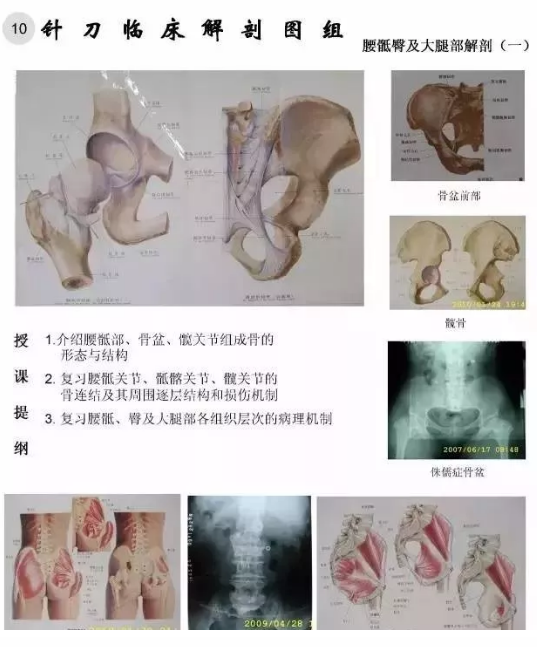 【针刀培训班】针刀临床解剖图干货知识赶快收了