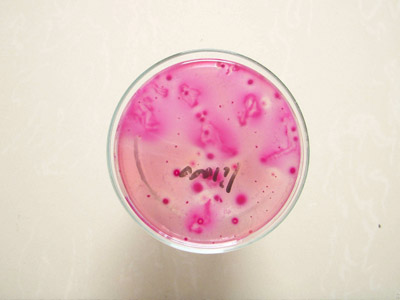小编与大家分享下两种常见的福建微生物检测方法