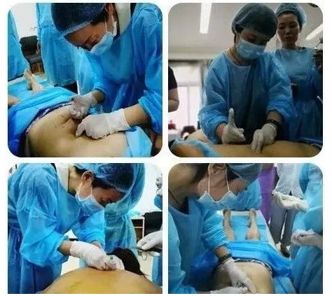 常见的疼痛病可以用穴位埋线来吗？作用大吗？