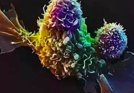 NK细胞免疫疗法有望治愈更多癌症患者