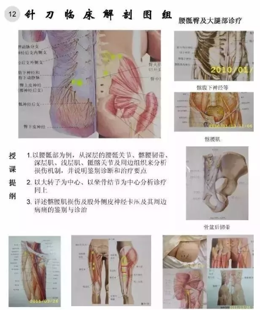 【针刀培训班】针刀临床解剖图干货知识赶快收了