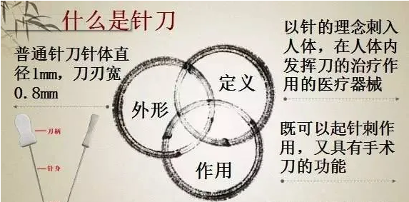 和派小圆针颈腰椎病、膝关节及疑难杂症