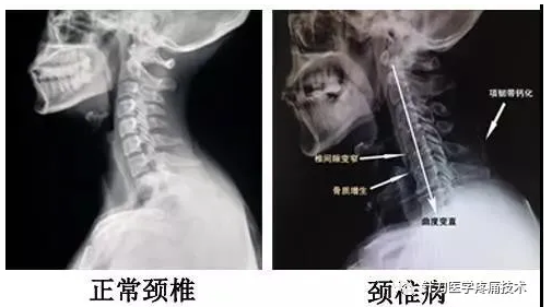 青岛脊椎影像医学查验读片与确诊培训班
