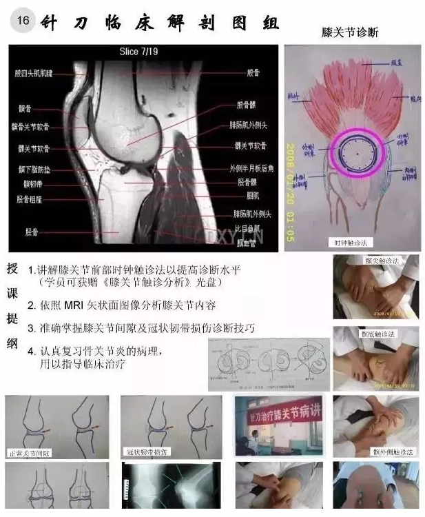 【针刀培训班】针刀临床解剖图干货知识赶快收了