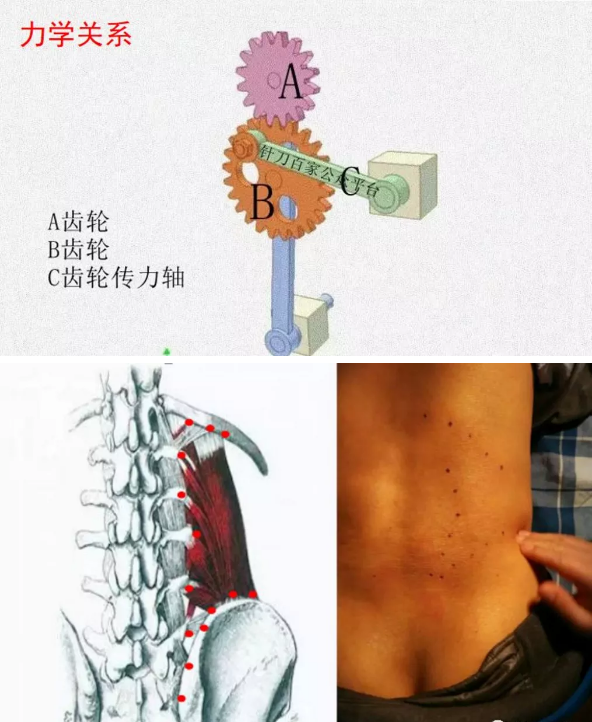 【针刀培训班】腰方肌与总体力线的关联