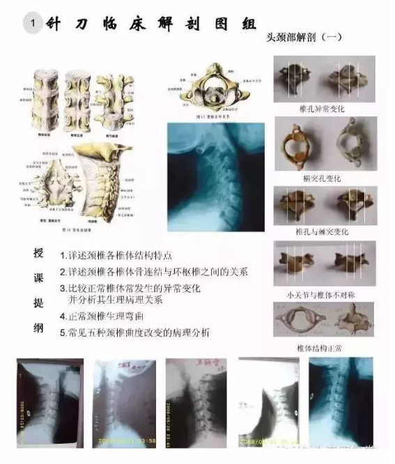 【针刀培训班】针刀临床解剖图干货知识赶快收了