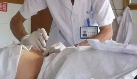 和派小圆针颈腰椎间盘突出、膝盖骨及疑难问题杂症