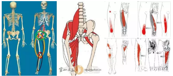 【针刀培训班】腰方肌与总体力线的关联