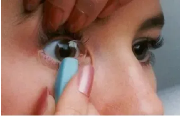 佩戴角膜塑形镜，眼睛出现红血丝怎么办？
