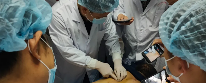 什么是银质针？