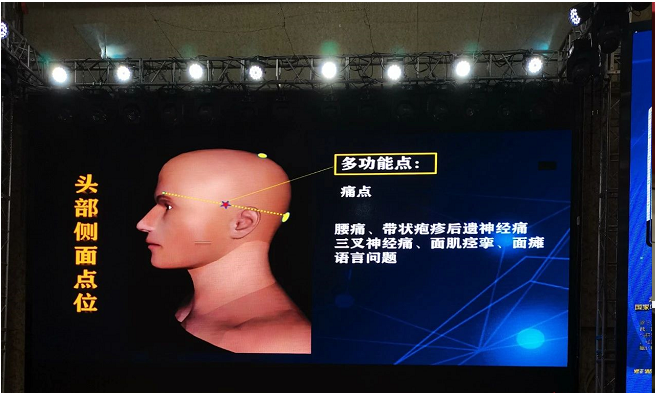 【3月20日成都】第十期宫氏髓针疗法+新脑针高研班，来啦！