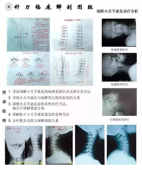 【针刀培训班】针刀临床解剖图干货知识赶快收了
