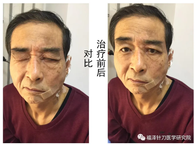 【5月15日大连市】针刀培训班——疑难问题杂症专题讲座线下推广公益性班