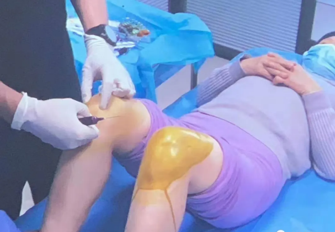 PRP技术骨病及膝关节精细解剖与系统化培训班