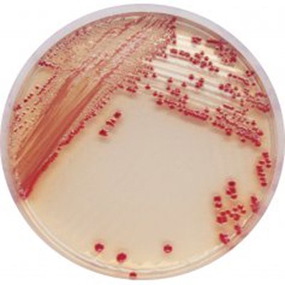 不动杆菌显色培养基平皿