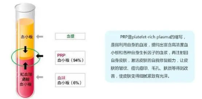 PRP技术骨病疼痛及美容临床应用研修班1月9日郑州举办