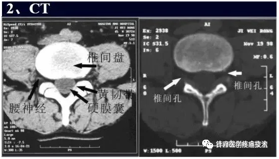 青岛脊椎影像医学查验读片与确诊培训班