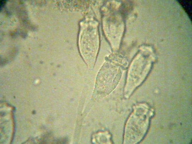 微生物活化