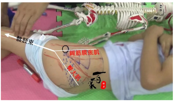 【针刀培训班】腰方肌与总体力线的关联