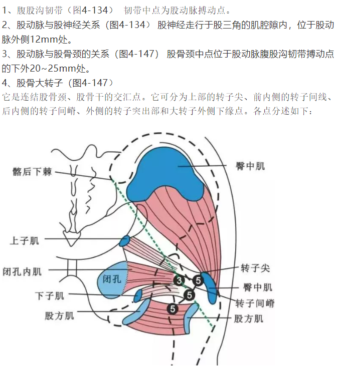 股骨头坏死的针刀精要