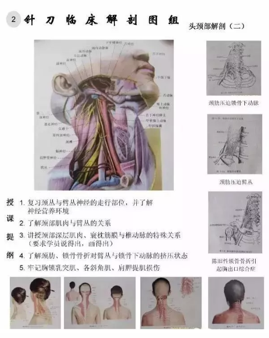 【针刀培训班】针刀临床解剖图干货知识赶快收了