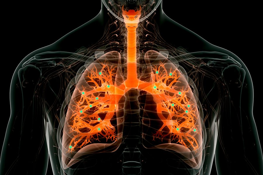 麻省理工学院:新的纳米粒子可以在肺部进行基因编辑