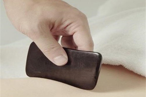 刮痧-潍坊本草堂中医医院有限公司