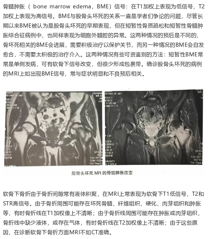 漯河正骨膏费用-娄氏骨病疗法康复网