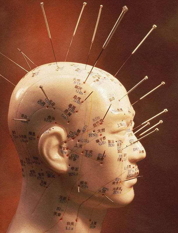 韶关针灸地址-正阳绝技