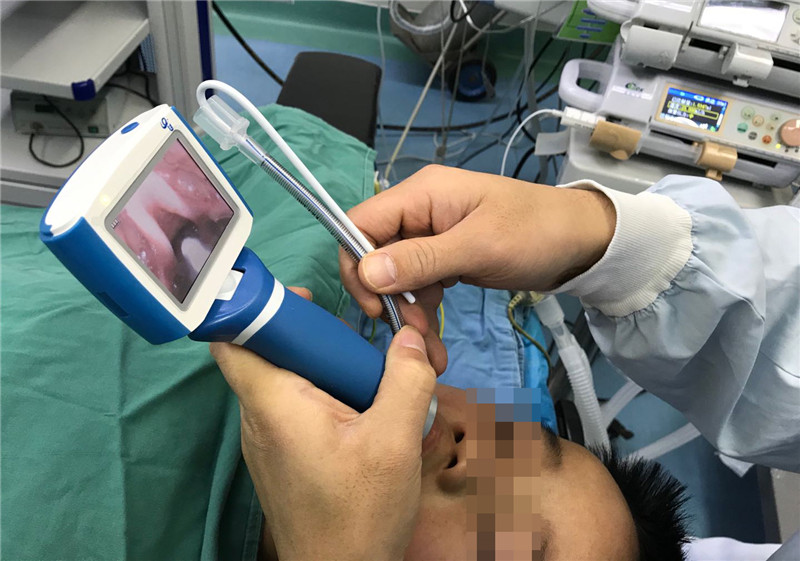 电子喉镜过程图片