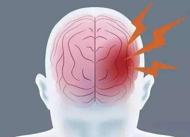 唐山腔隙性脑梗塞日常护理